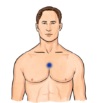 thymus-tapping