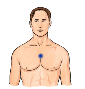 thymus-tapping